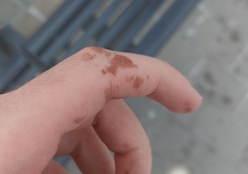 The Hidden Dangers of Silver Nitrate Exposure