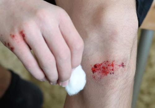 Laceration Vs Abrasion: What's the Difference and How Silver Nitrate Can Speed up Healing